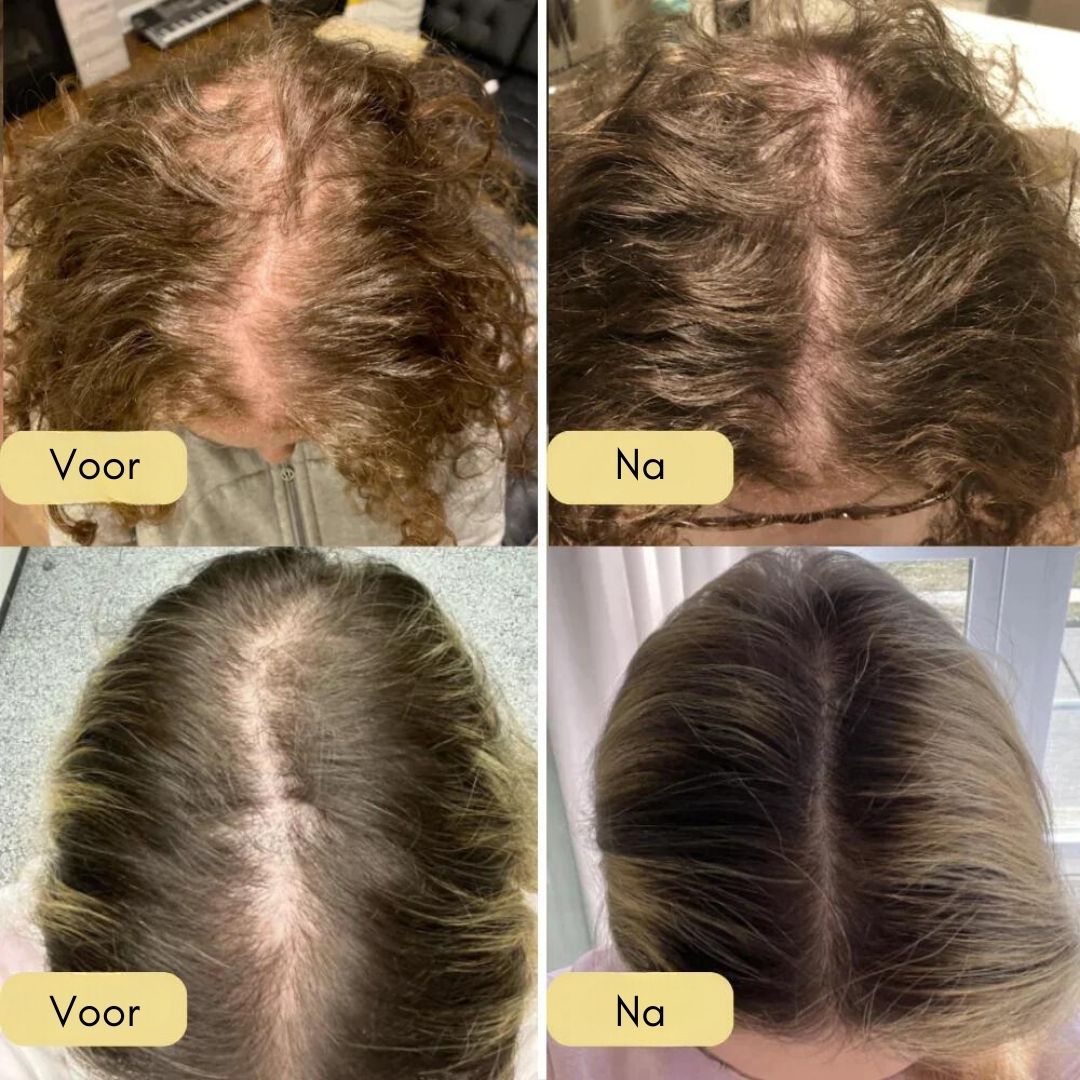 Your Natural Oil for Hair Growth