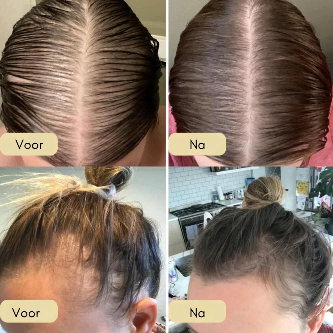 Your Natural Oil for Hair Growth