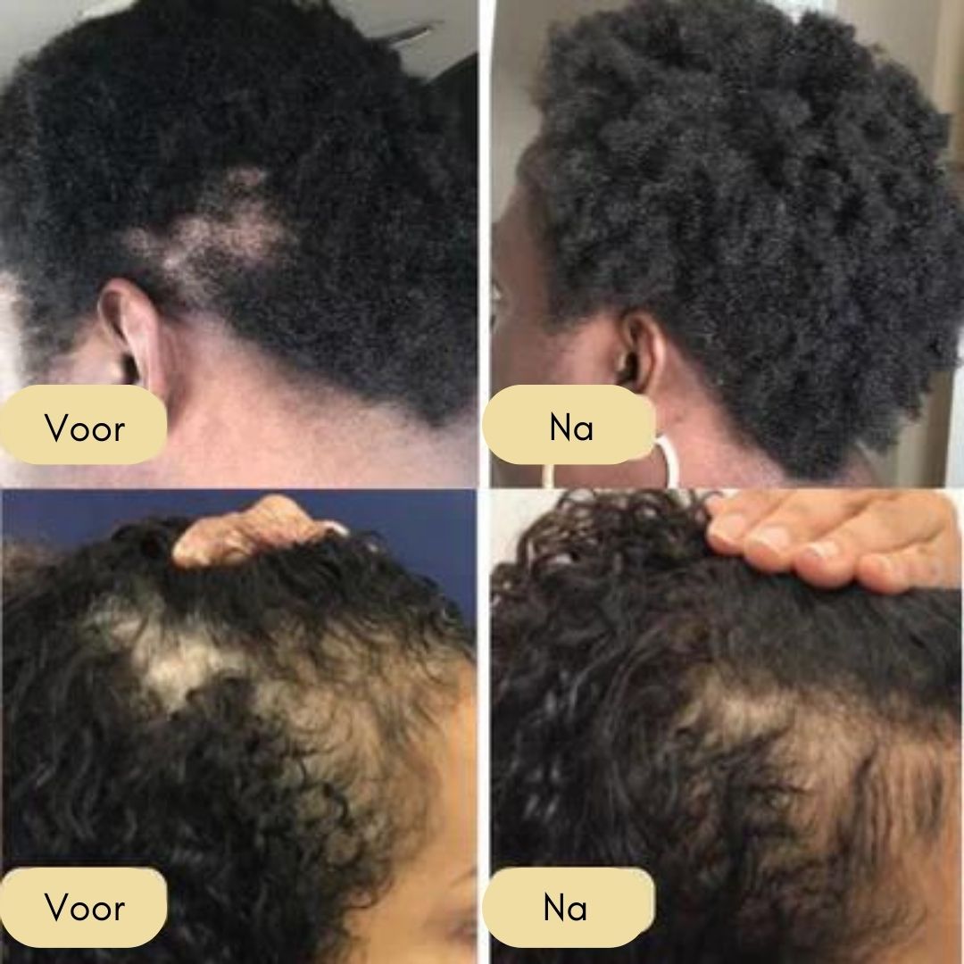 Your Natural Oil for Hair Growth