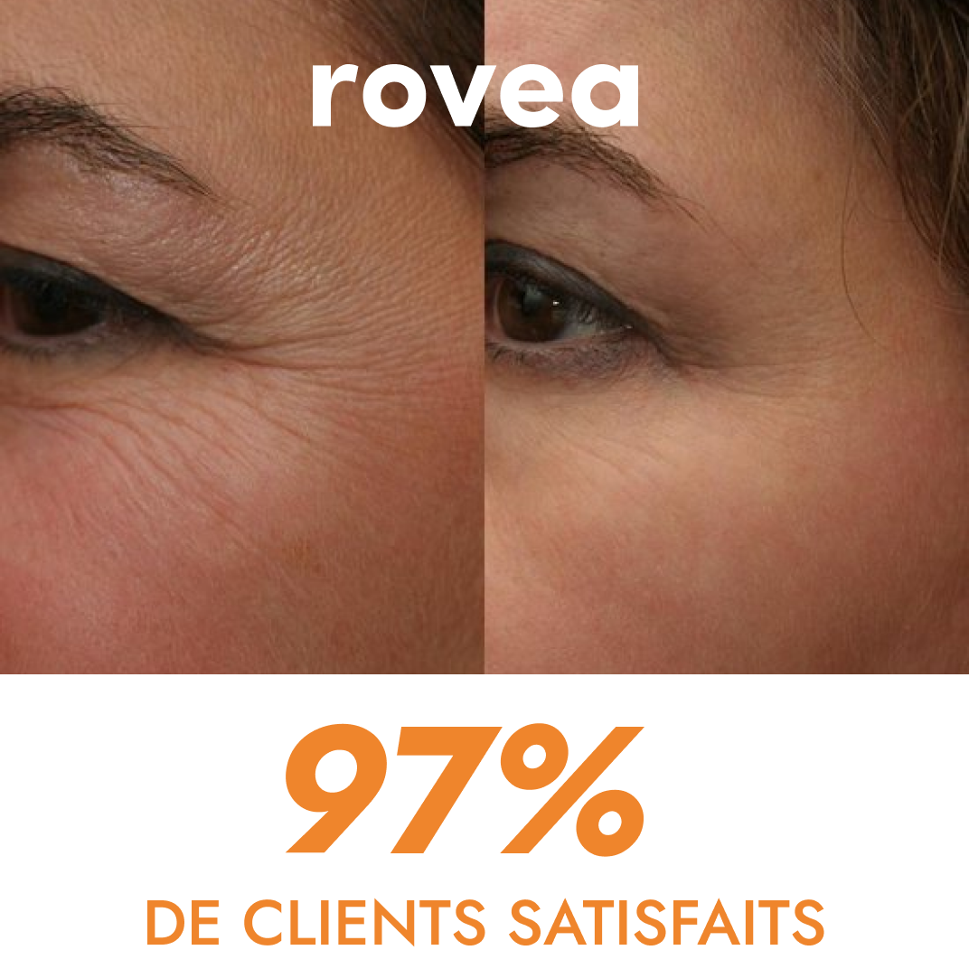 Korean Invisible Collagen Mask (Eyes)