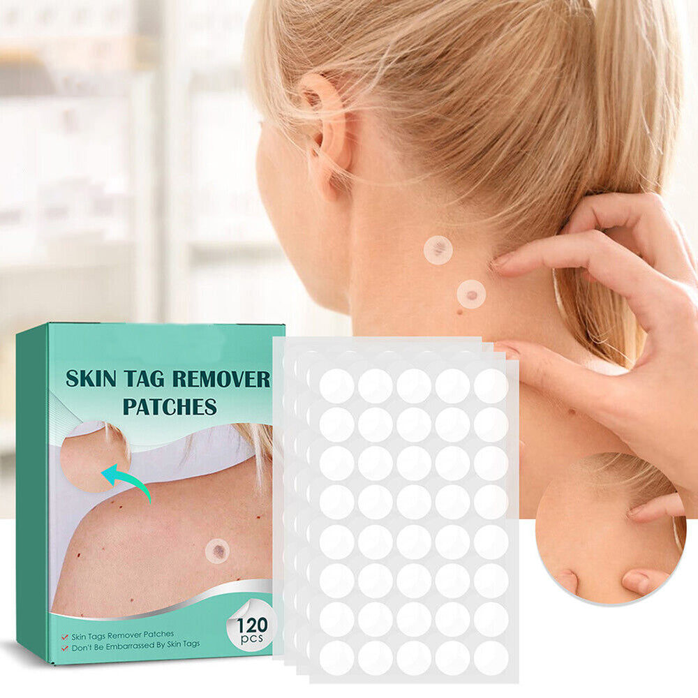 skin tag remover, skin tags removal patches, wart removal patches, skin blemish removal, skin tag patches, skin imperfections removal, fast skin tag removal, effective wart remover, safe skin blemish patch, quick removal skin tags, gentle skin imperfection patches, painless wart removal solution, discreet skin tag removal patches, targeted skin blemish treatment, easy skin patch removal method