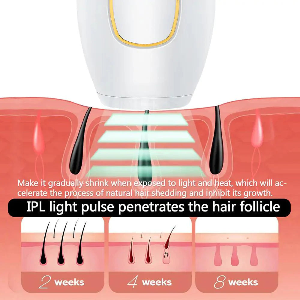 IPL Laser Hair Removal