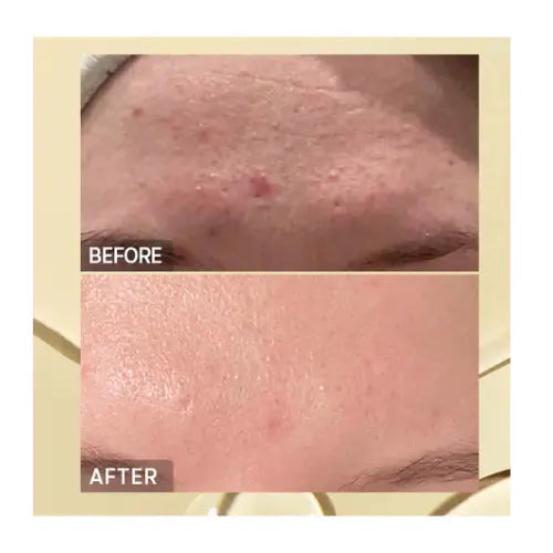 Advanced Snail96 Mucin Power Essence