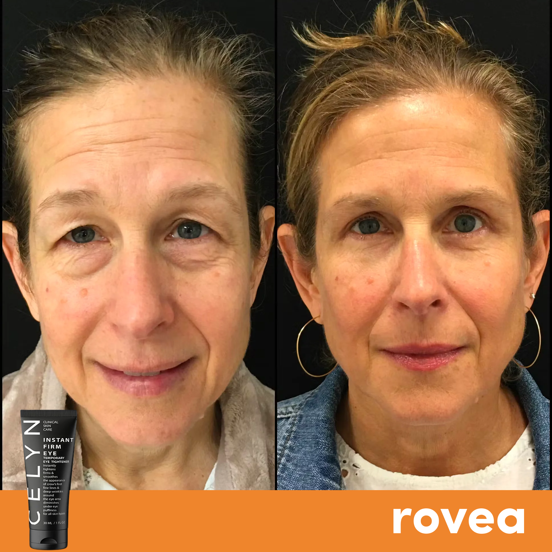 Instant Eye Dark Circle and Wrinkle Cream