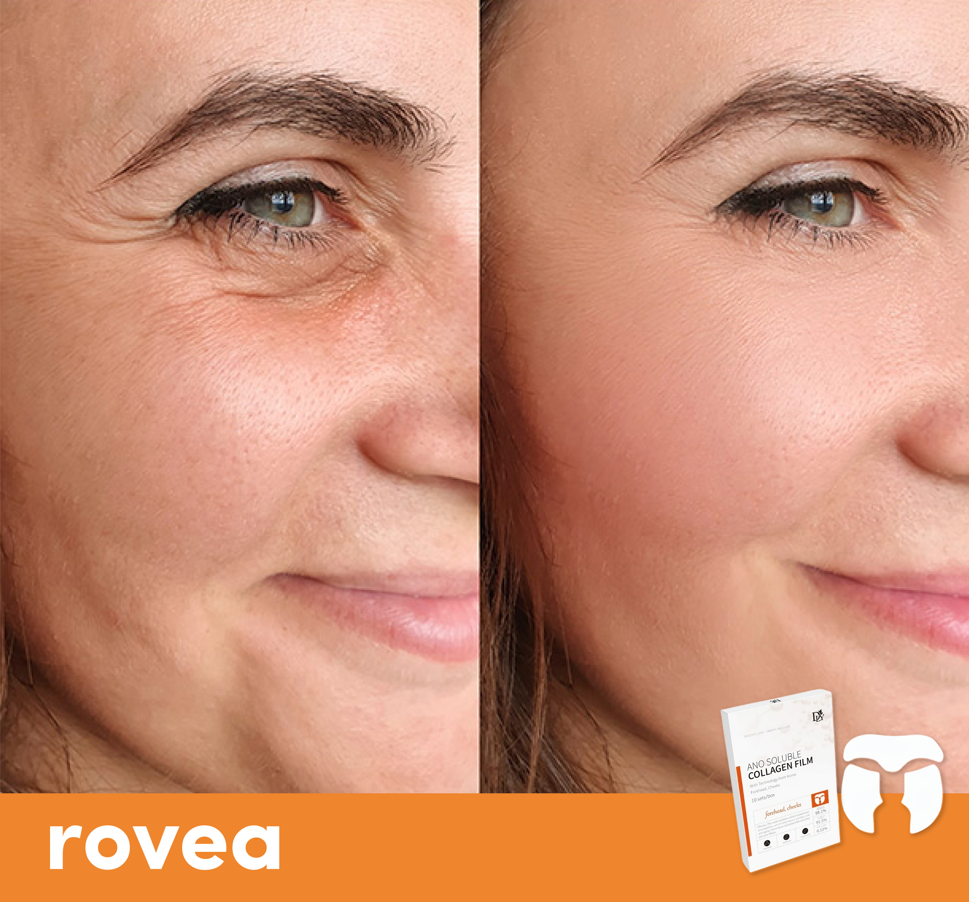 Invisible Korean Collagen Face Mask (Cheeks and Forehead)